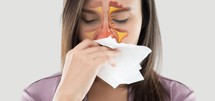Las 8 infecciones respiratorias que la mayoría padecerá este invierno